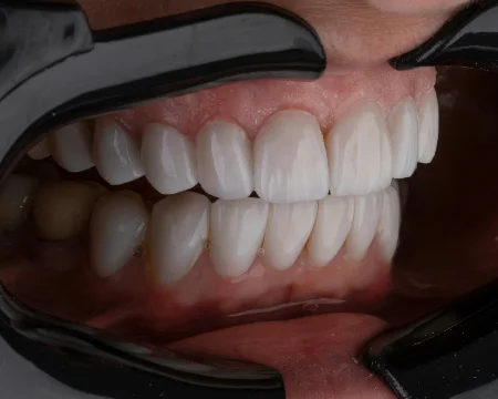 Treatment photo